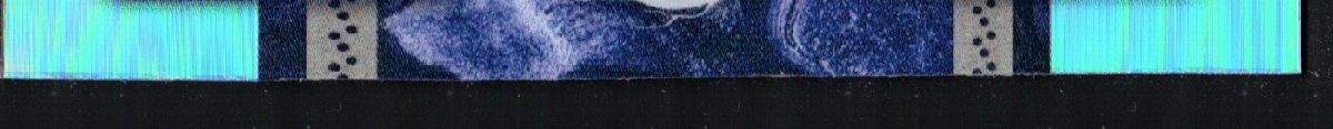 bottom edge