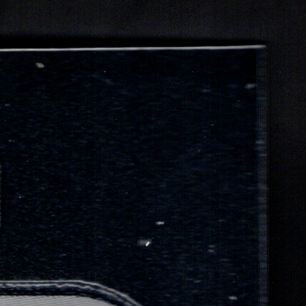 Front · Top Right
